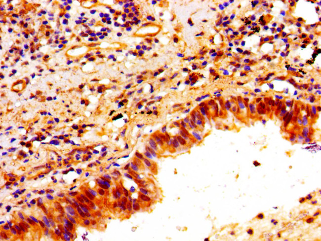 PTX3 Antibody in Immunohistochemistry (Paraffin) (IHC (P))