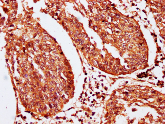 SERPINB2 Antibody in Immunohistochemistry (Paraffin) (IHC (P))