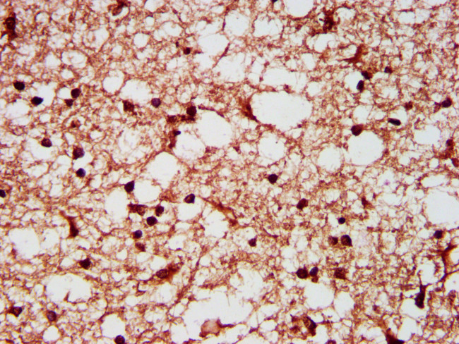 SF3B1 Antibody in Immunohistochemistry (Paraffin) (IHC (P))