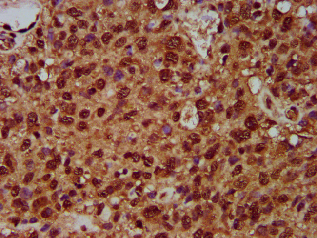 SF3B1 Antibody in Immunohistochemistry (Paraffin) (IHC (P))