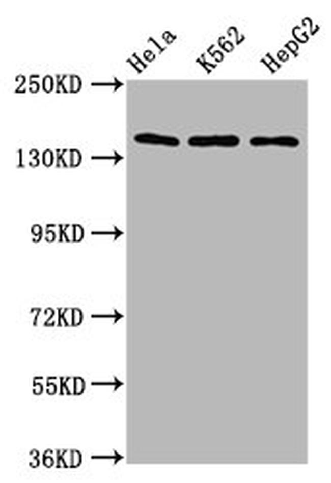 SF3B1 Antibody in Western Blot (WB)