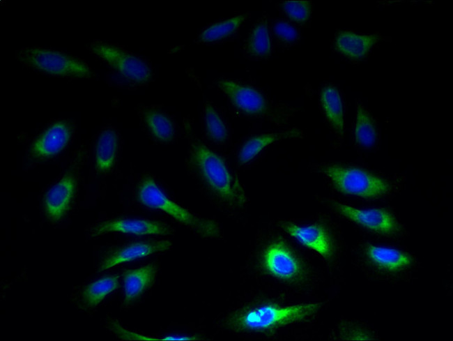 SLC1A6 Antibody in Immunocytochemistry (ICC/IF)