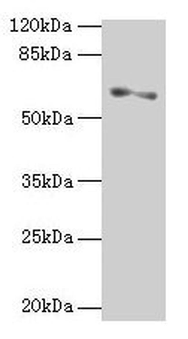 SLC1A6 Antibody in Western Blot (WB)