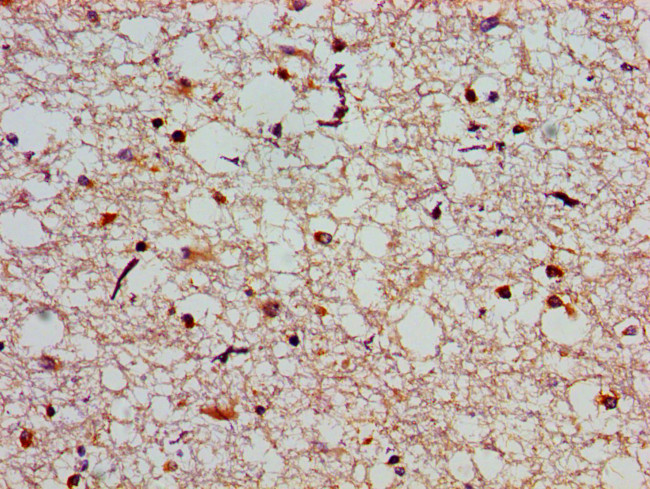 SLC25A12 Antibody in Immunohistochemistry (Paraffin) (IHC (P))