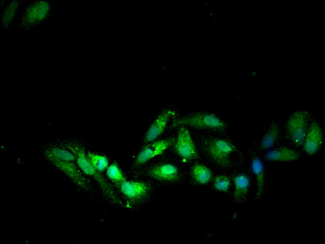 SOCS7 Antibody in Immunocytochemistry (ICC/IF)