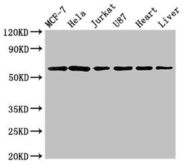 SOCS7 Antibody in Western Blot (WB)