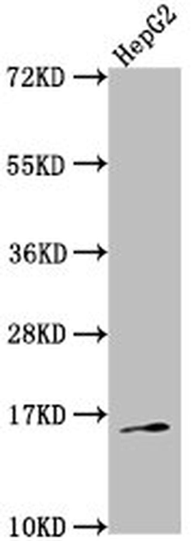 Neurokinin A Antibody in Western Blot (WB)