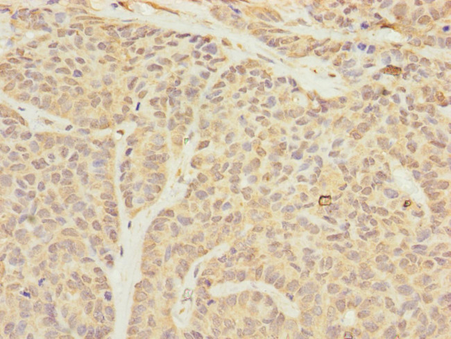 TIMM23 Antibody in Immunohistochemistry (Paraffin) (IHC (P))