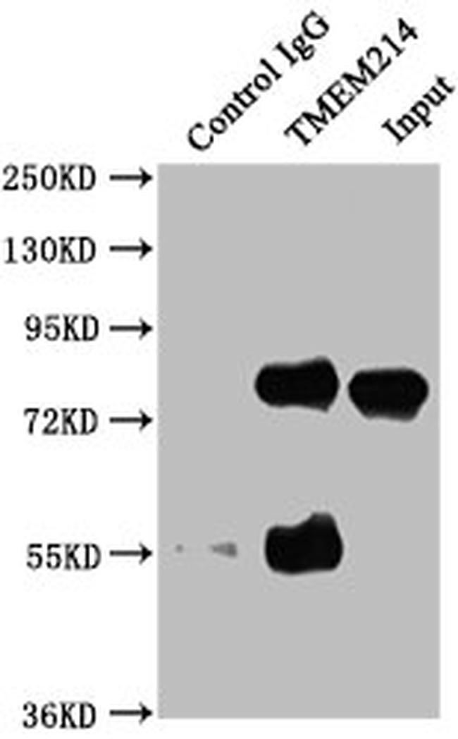 TMEM214 Antibody in Western Blot (WB)