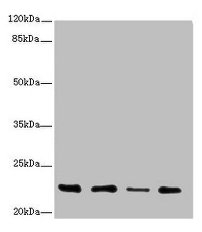 TNFAIP8 Antibody in Western Blot (WB)