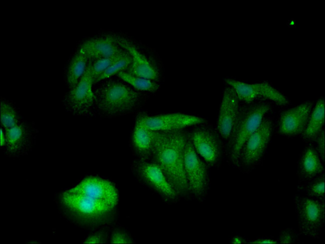 TXK Antibody in Immunocytochemistry (ICC/IF)