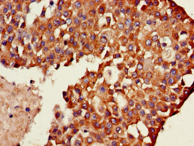 TXK Antibody in Immunohistochemistry (Paraffin) (IHC (P))