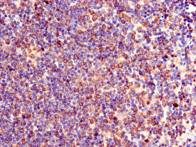 TXK Antibody in Immunohistochemistry (Paraffin) (IHC (P))