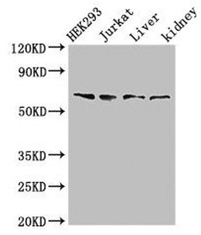 TXK Antibody in Western Blot (WB)