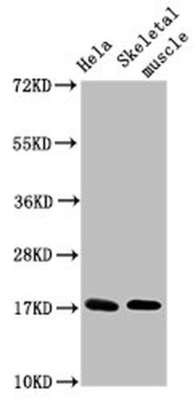 UBE2D3 Antibody in Western Blot (WB)