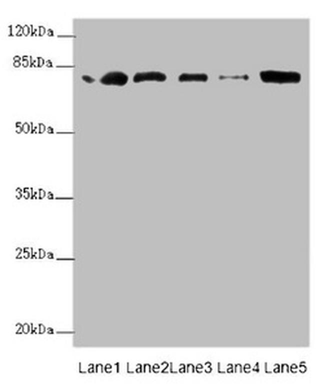 ZBTB48 Antibody in Western Blot (WB)