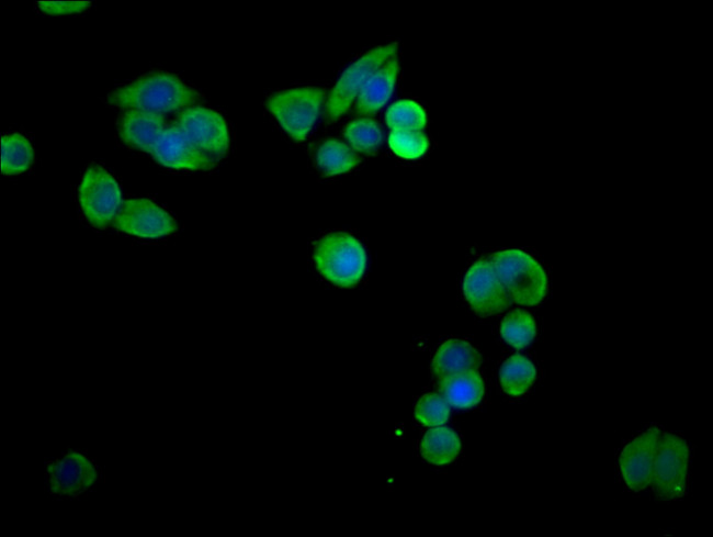 SLC6A8 Antibody in Immunocytochemistry (ICC/IF)