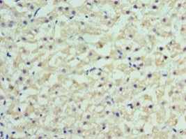 RBP4 Antibody in Immunohistochemistry (Paraffin) (IHC (P))