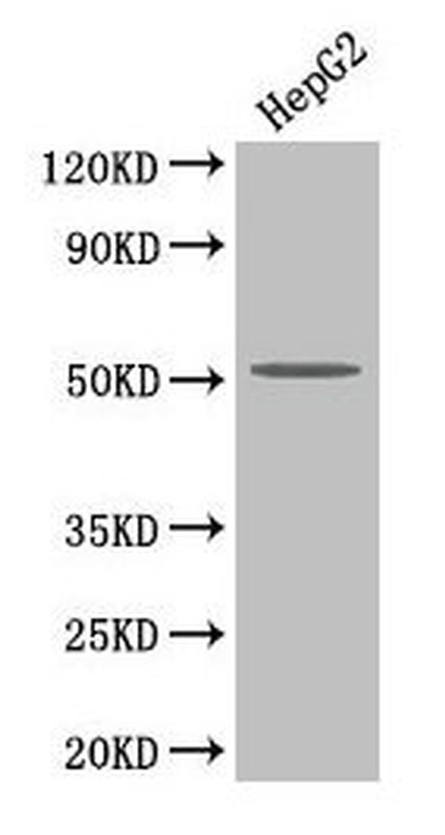 PLA2G7 Antibody in Western Blot (WB)