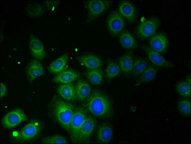 TROVE2 Antibody in Immunocytochemistry (ICC/IF)