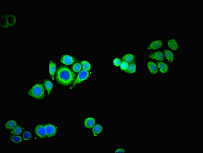 TROVE2 Antibody in Immunocytochemistry (ICC/IF)