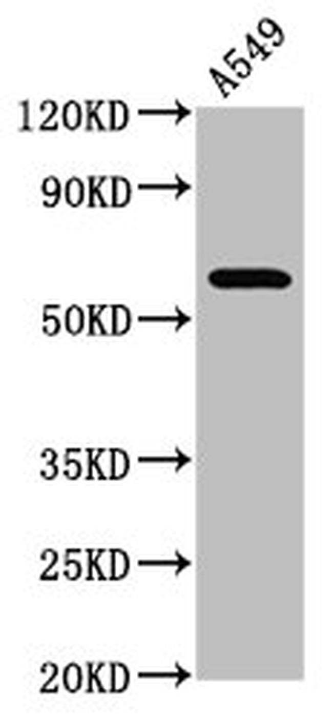 PDE9A Antibody in Western Blot (WB)