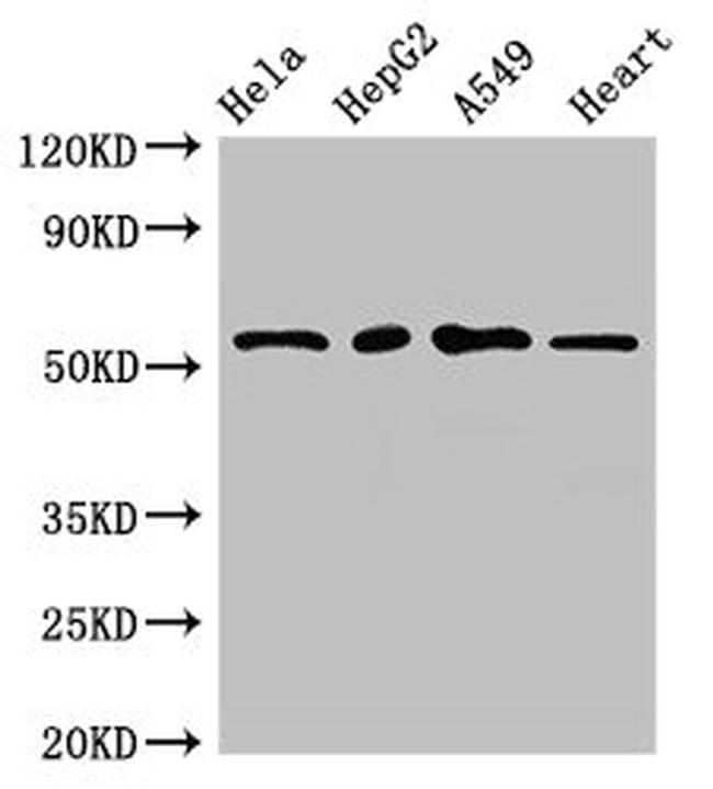 MEF2D Antibody in Western Blot (WB)