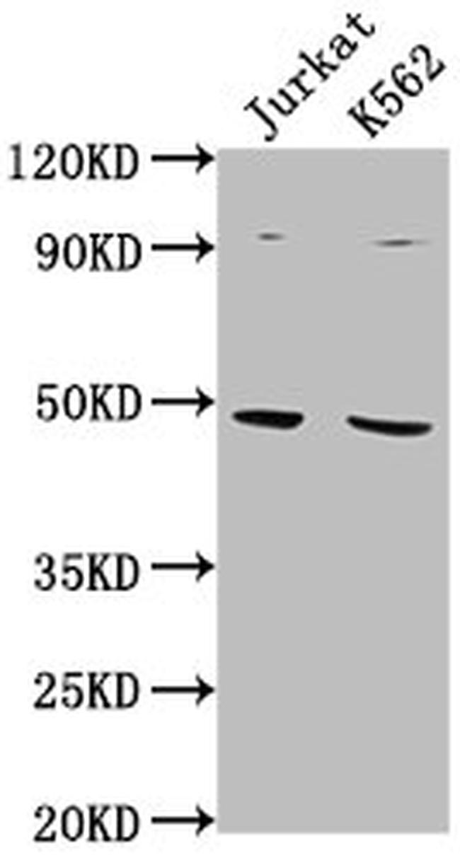 PSMD6 Antibody in Western Blot (WB)