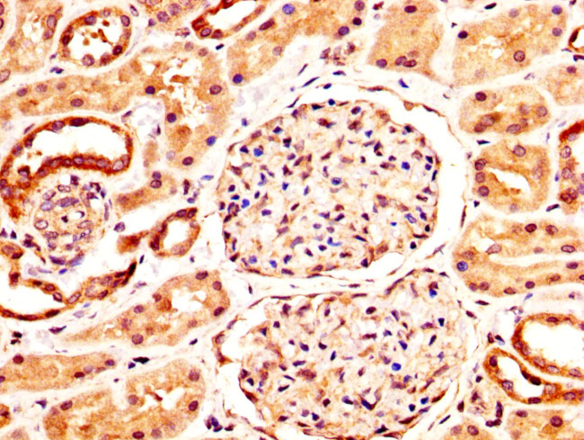 NFATC3 Antibody in Immunohistochemistry (Paraffin) (IHC (P))