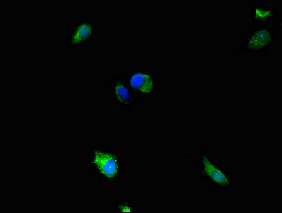 MEK5 Antibody in Immunocytochemistry (ICC/IF)