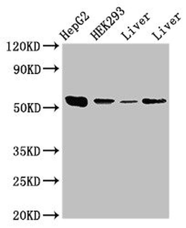 MEK5 Antibody in Western Blot (WB)