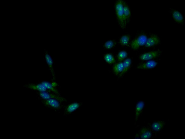 DMC1 Antibody in Immunocytochemistry (ICC/IF)