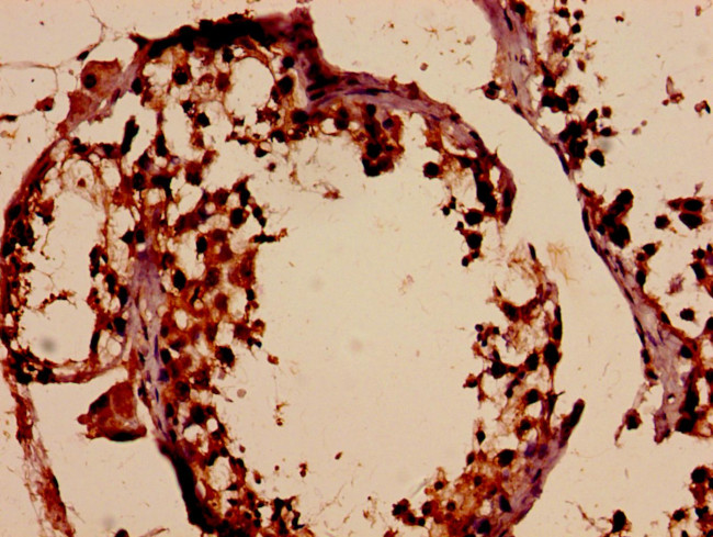 DMC1 Antibody in Immunohistochemistry (Paraffin) (IHC (P))