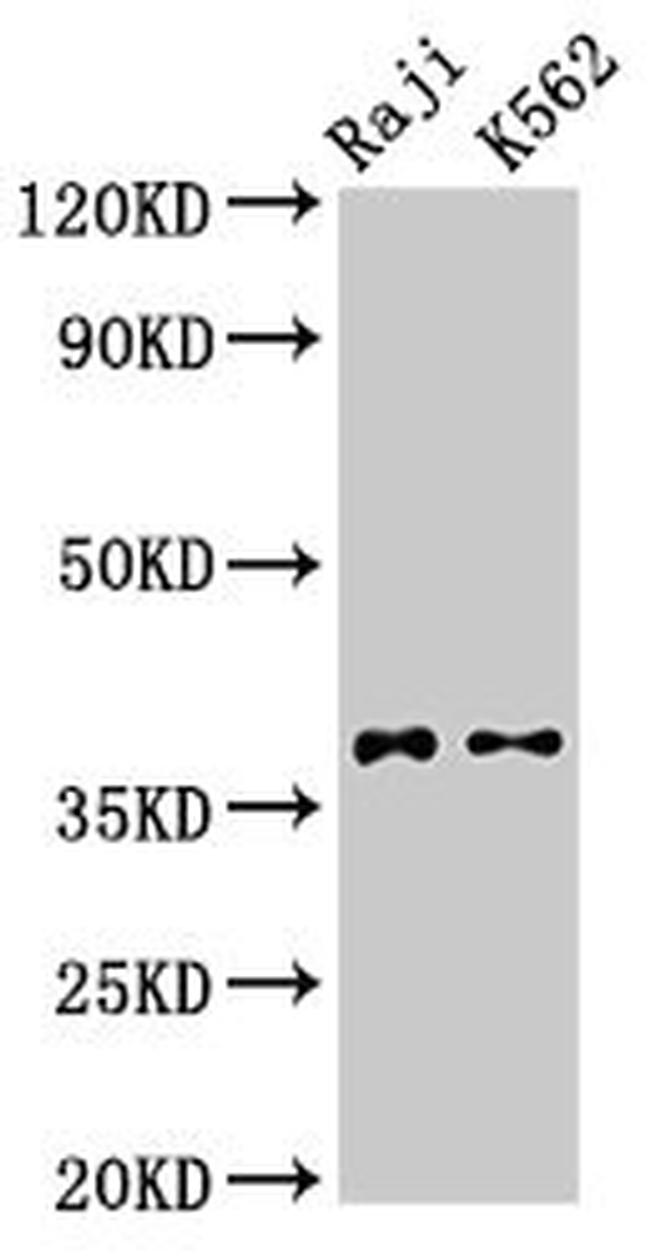 DMC1 Antibody in Western Blot (WB)