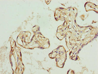 TRIP13 Antibody in Immunohistochemistry (Paraffin) (IHC (P))