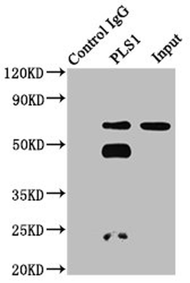 PLS1 Antibody in Western Blot (WB)