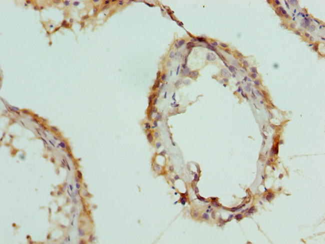 CPSF3L Antibody in Immunohistochemistry (Paraffin) (IHC (P))