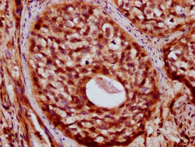 ZC3H14 Antibody in Immunohistochemistry (Paraffin) (IHC (P))