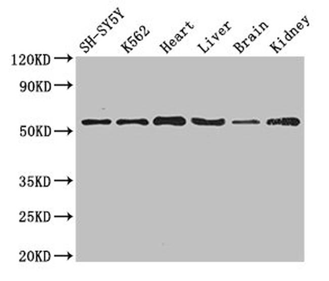SLC16A9 Antibody in Western Blot (WB)