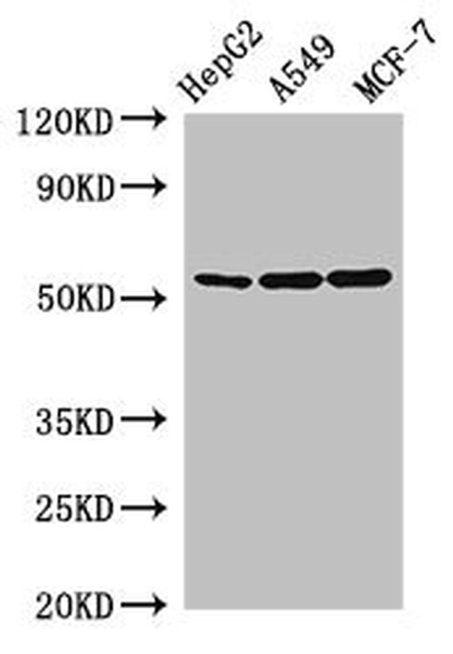 SLC24A5 Antibody in Western Blot (WB)