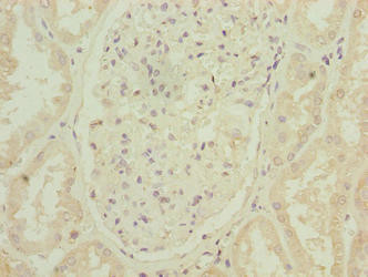 ARPIN Antibody in Immunohistochemistry (Paraffin) (IHC (P))