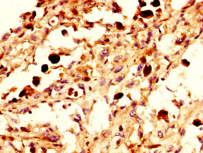 NPAS4 Antibody in Immunohistochemistry (Paraffin) (IHC (P))