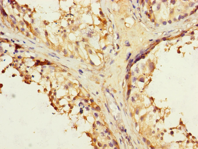 IFNLR1 Antibody in Immunohistochemistry (Paraffin) (IHC (P))