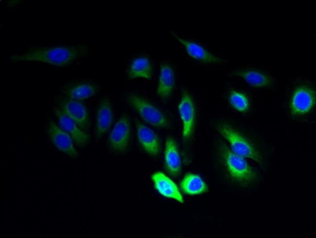 JAGN1 Antibody in Immunocytochemistry (ICC/IF)