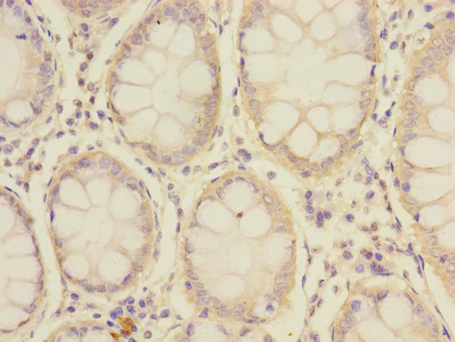 SLC39A7 Antibody in Immunohistochemistry (Paraffin) (IHC (P))