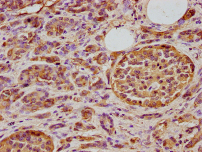 TID1 Antibody in Immunohistochemistry (Paraffin) (IHC (P))