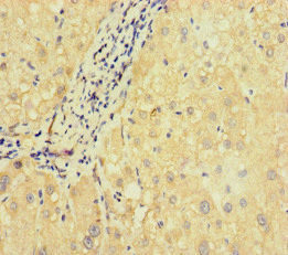 SLC38A9 Antibody in Immunohistochemistry (Paraffin) (IHC (P))