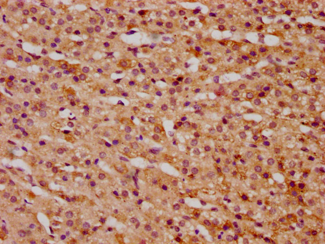 KTI12 Antibody in Immunohistochemistry (Paraffin) (IHC (P))