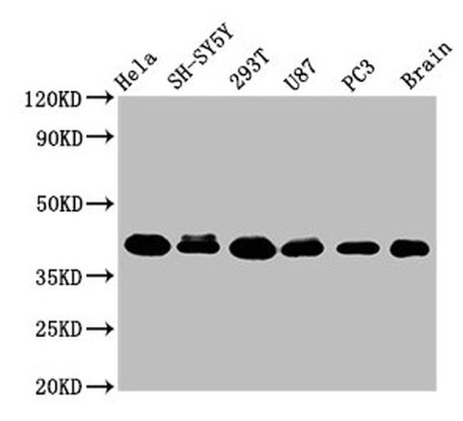 KTI12 Antibody in Western Blot (WB)