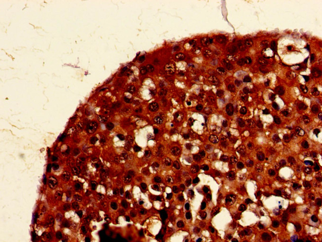 PIGK Antibody in Immunohistochemistry (Paraffin) (IHC (P))